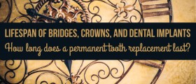 Lifespan Of Bridges, Crowns, And Dental Implants: How Long Does A Permanent Tooth Replacement Last?