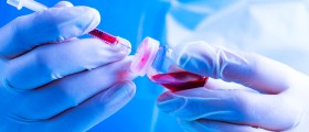 The Link Between Septicemia, Sepsis, And E.Coli: How Can Escherichia Coli Cause A Blood Infection?