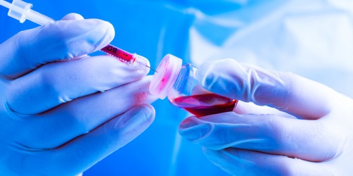 The Link Between Septicemia, Sepsis, And E.Coli: How Can Escherichia Coli Cause A Blood Infection?