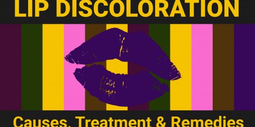 Lip Discoloration: Causes, Treatment, and Remedies