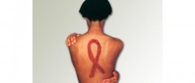 Living with AIDS