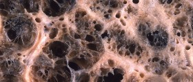An Aspirin A Day Keeps Emphysema Away?
