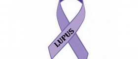 Lupus in Women: Chronic Inflammatory Disease