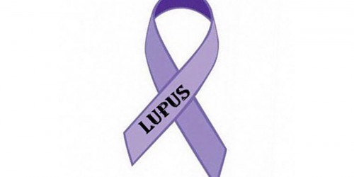 Lupus in Women: Chronic Inflammatory Disease