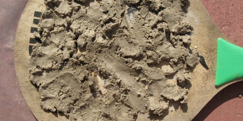 Magnesium Deficiency: A Silent Epidemic?