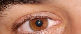 Gene Therapy Combats Hereditary Blindness
