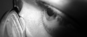 Ocular Albinism Symptoms and Treatment