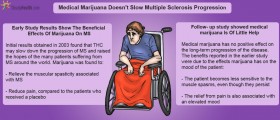Medical Marijuana Doesn't Slow Multiple Sclerosis Progression