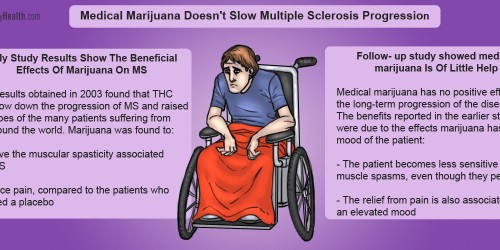 Medical Marijuana Doesn't Slow Multiple Sclerosis Progression