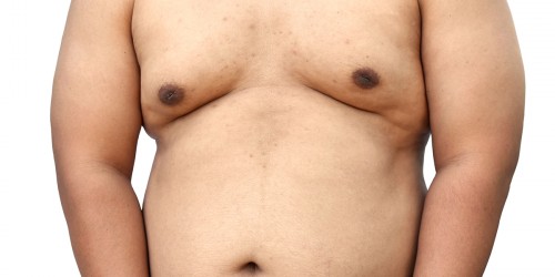How do I get rid of the man boobs?