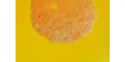 Magnesium Deficiency: A Silent Epidemic?