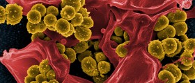 Slight Progress Against Major Killer, Hospital-Acquired Infections