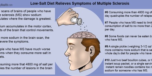 Sodium Buildup In Brain Linked To MS