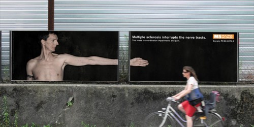 Is Stem Cell Transplantation A New Cure For Multiple Sclerosis?