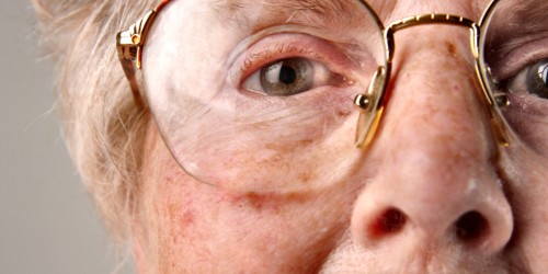 4 Things You Should Know About Muscle Spasms (Myoclonus) And Uncontrollable Twitches