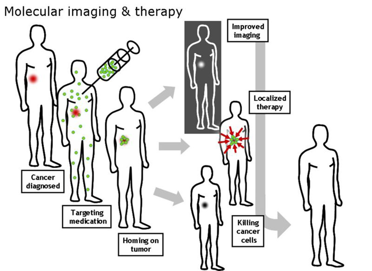 Nanotheranostics – Simultaneous Use Of Nanomedicine-Based Therapeutic ...