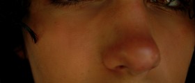 What!? You Can Be Addicted To Afrin Nasal Spray??