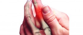 Neuropathy