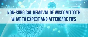Non-Surgical Removal Of Wisdom Tooth: What To Expect And Aftercare Tips