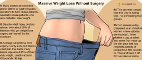 Can You Lose 100 Pounds Without Surgery?