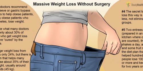 Can You Lose 100 Pounds Without Surgery?