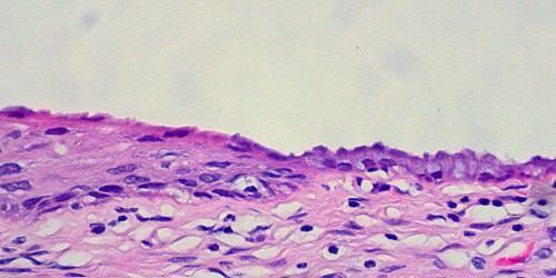 What Is An Incompetent Cervix During Pregnancy?