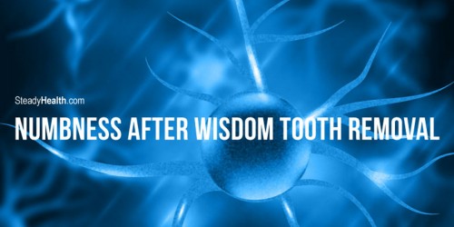 Numbness After Wisdom Tooth Removal: What Now?