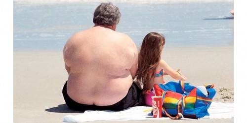 Gastric Bypass Success, But No Surgery