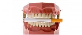 Oral Cancer: Risks, Causes, Symptoms and Treatments
