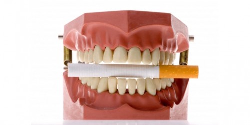 Oral Cancer: Risks, Causes, Symptoms and Treatments