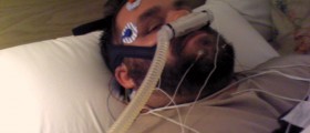 Can Pacemakers Cure Obstructive Sleep Apnea?