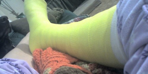 Osteomyelitis: Symptoms & Treatment