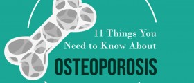 Understanding Osteoporosis: 11 Things You Should Know About Brittle Bones