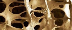 Why Vitamin K2 Is Critical For Good Heart And Bone Health