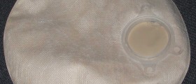 Living With A Colostomy Bag: What You Need To Know