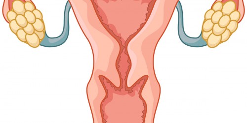 Cervical cancer prevention: How to reduce the risk?