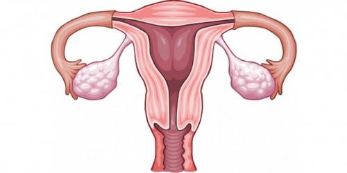 Pelvic Pain: Home Remedies for Pelvic Inflammatory Disease