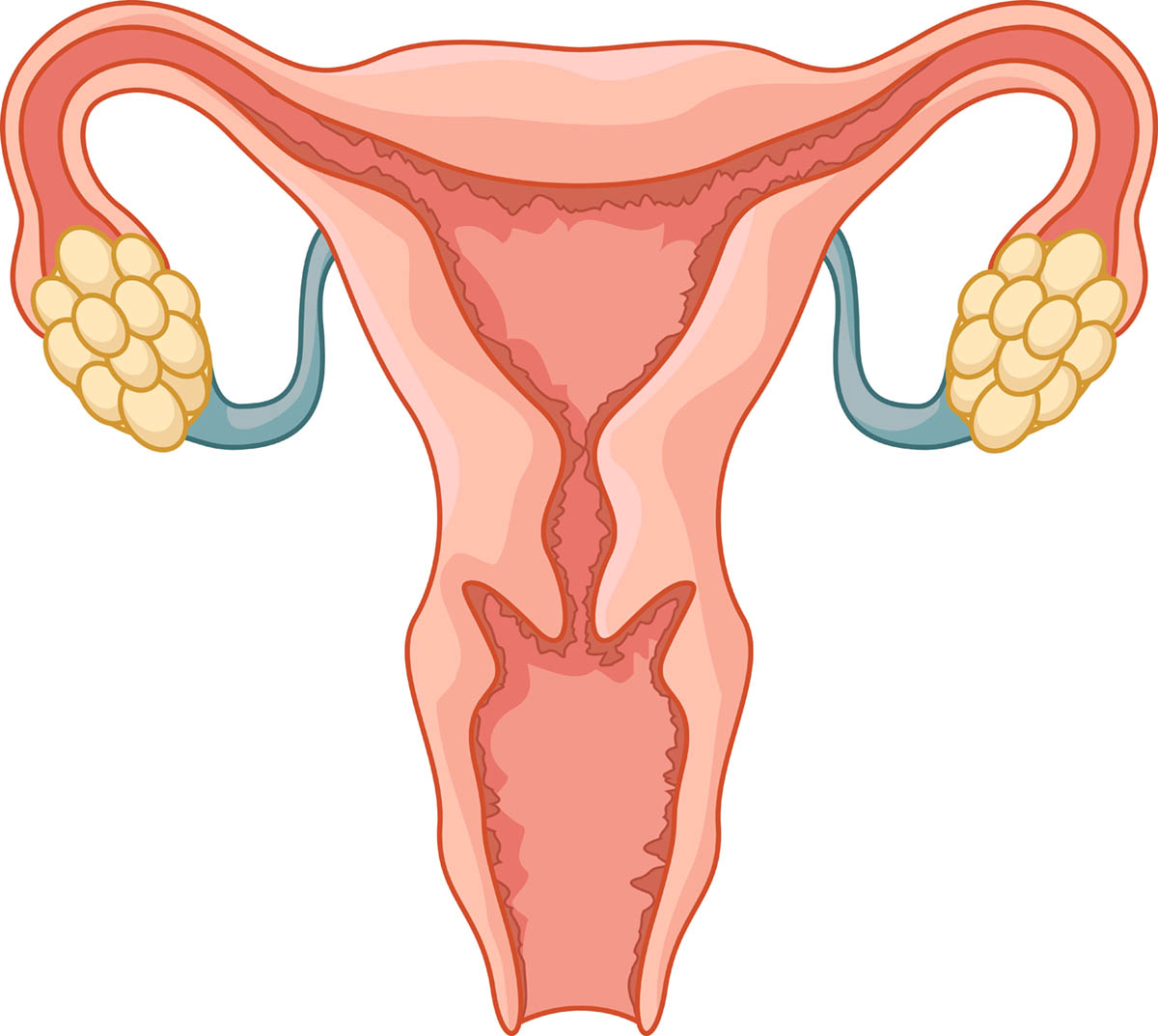 Ovarian Cancer Spread To The Abdomen