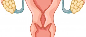 Ovarian cancer: Causes, symptoms risk factors, treatment and prevention