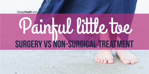 Bunionette pain relief: Surgery vs. Home Treatment For Management Of Painful Little Toe