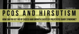 PCOS And Hirsutism: How Can You Get Rid Of Excess Hair Growth Caused By Polycystic Ovary Syndrome?