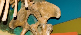 Causes of pelvic pain in women
