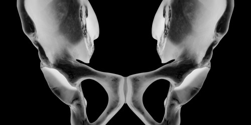 Snapping Hip Syndrome