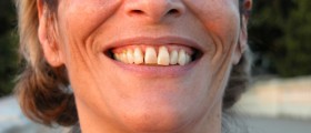A Brief Look At Periodontal Surgery
