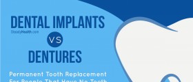 Permanent Tooth Replacement For People That Have No Teeth: Dental Implants vs Dentures