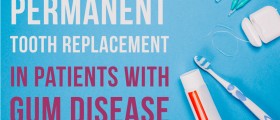 Permanent Tooth Replacement In Patients With Gum Disease