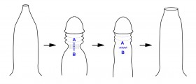 Phimosis Treatment