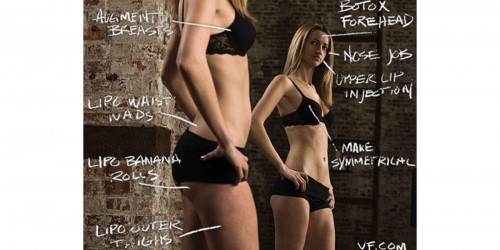 After Liposuction, the Fat will Return and Redistribute in the Upper Abdomen, Shoulders and Triceps