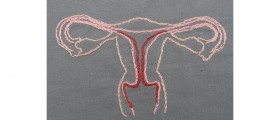 Polycystic Ovary Syndrome (PCOS): How to correct your hormonal imbalance?