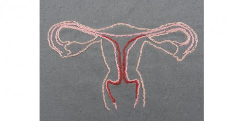 Polycystic Ovary Syndrome (PCOS): How to correct your hormonal imbalance?